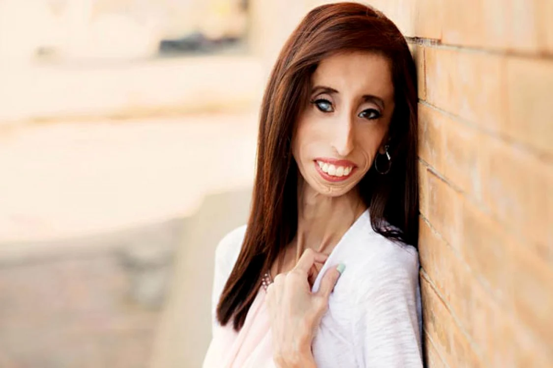 Lizzie Velasquez nu are de gând să fie doborâtă de percepţia oamenilor din jurul ei