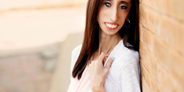 lizzie velasquez