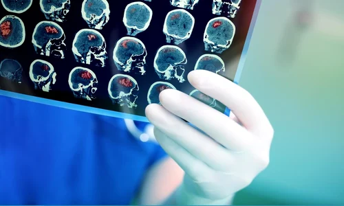 shutterstock 390249514(1) jpg