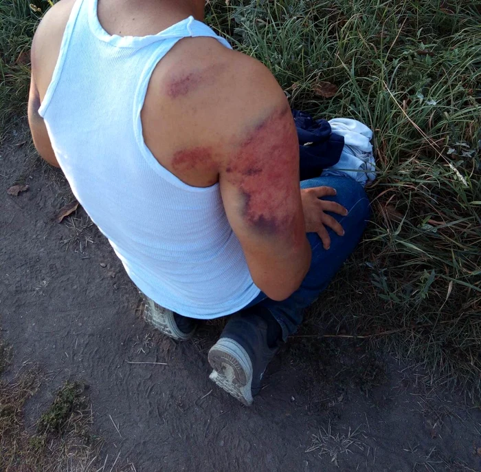 Acest refugiat îi acuză pe polițiștii români de frontieră că l-au bătut Fotografii: Twitter