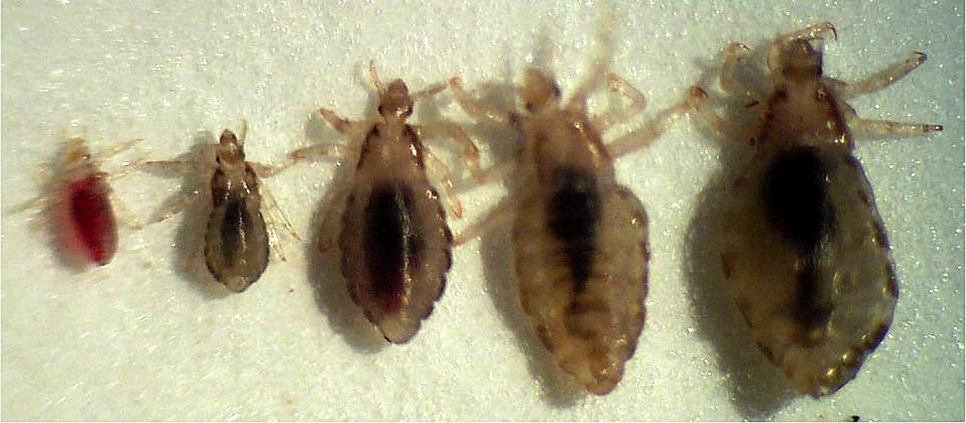 paduchi sursa pest control 