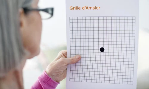 Grila Amsler jpg
