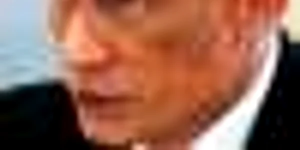 Vânătaia de sub ochi, o dovadă că Putin şi-ar fi injectat botox în obraji