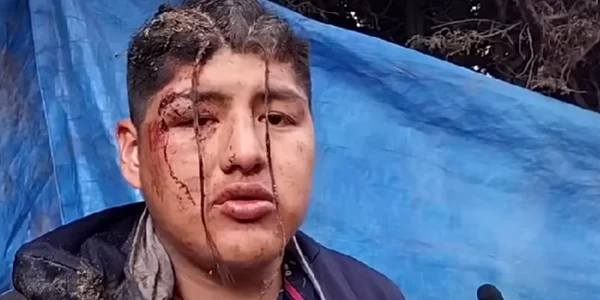 Un barbat a fost ingropat de viu