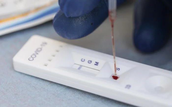 Să fie testele prea puține explicația numărului mic de îmbolnăviri cu virusul ucigaș în anumite județeFoto: Inquam Photos / George Calin