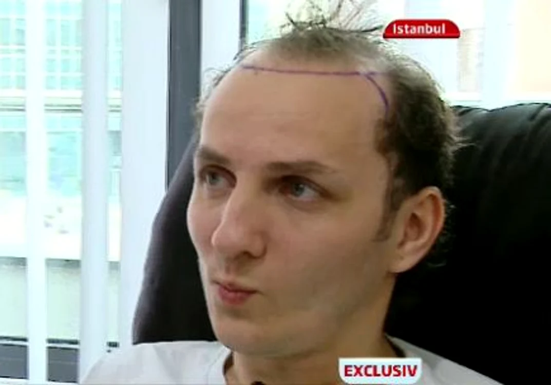 Mihai s-a declarat mulţumit de forma pe care o va avea părul său (fotocaptură: PRO TV)