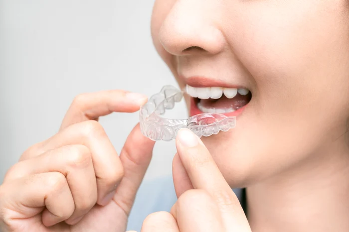 1 aparat dentar transparent jpg jpeg
