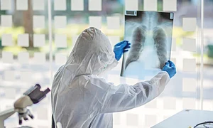 ”Avem zeci de pacienți cu afectare pulmonară severă după ce s au vindecat de COVID 19”, spune managerul institutului jpeg