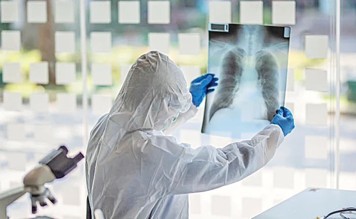 ”Avem zeci de pacienți cu afectare pulmonară severă după ce s-au vindecat de COVID-19”, spune managerul institutului