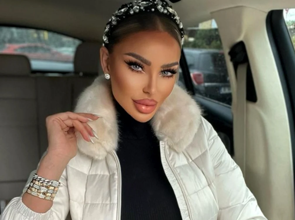 Bianca Drăgușanu a decis să își schimbe forma buzelor Foto: Instagram