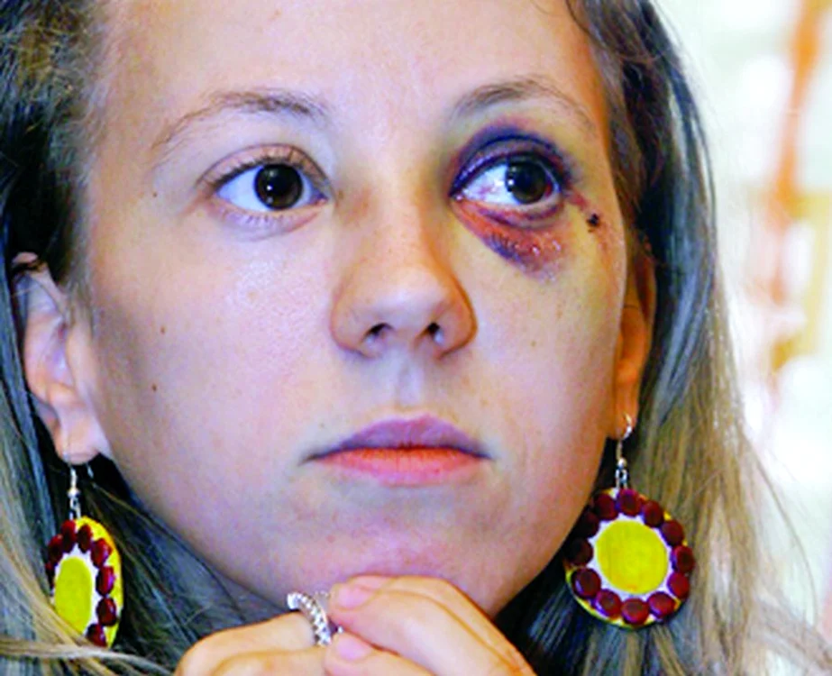 Larisa s-a despărţit de gimnast după ce a bătut-o crunt