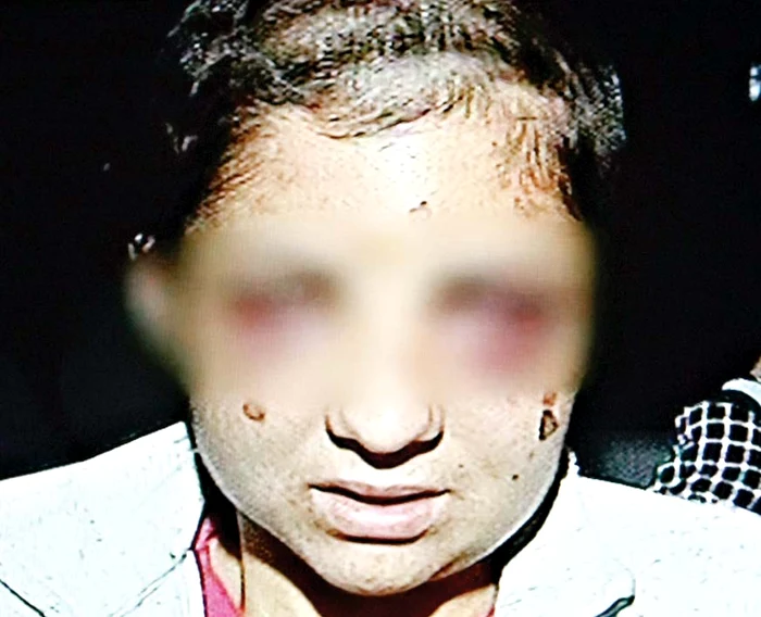 Soţia înşelată s-a răzbunat crunt: a ars-o pe tânără cu ţigara şi i-a tăiat lobul urechii (Foto: Capturi antena 1)