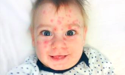 1 71964 original jpg jpeg