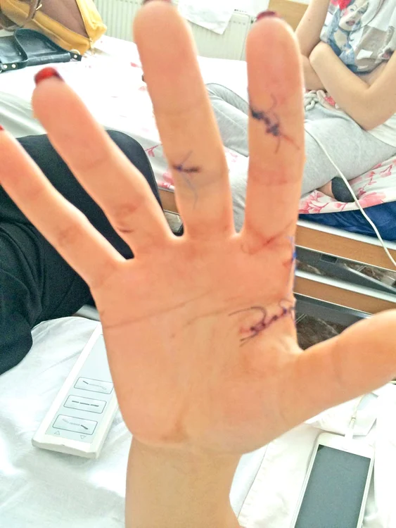
    Diana a stat trei zile în spital din cauza rănilorFoto: arhivă personală  