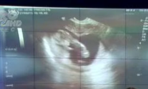 Aceasta este prima ecografie a copilului Oanei Roman (captură: PRO TV) jpeg
