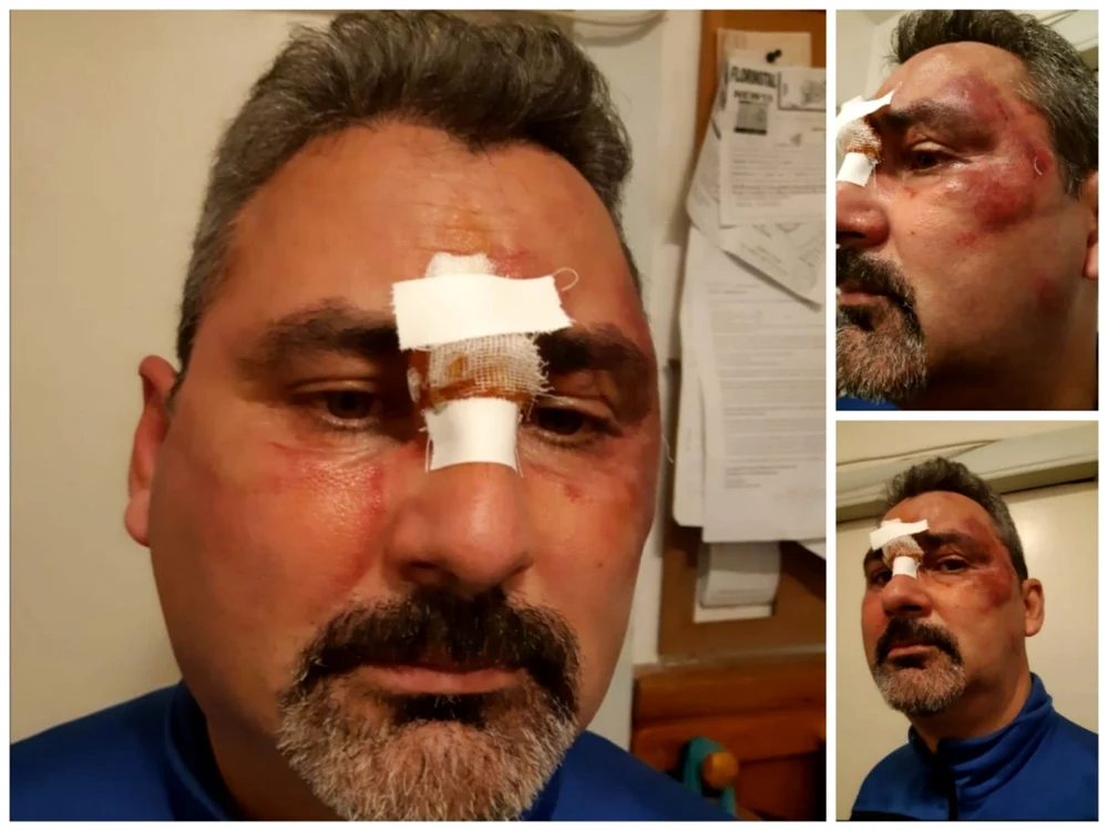 Alin Bălan a fost transportat la spital de un echipaj de prim-ajutor, în urma apelului la 112 FOTO: arhiva personală Alin Bălan
