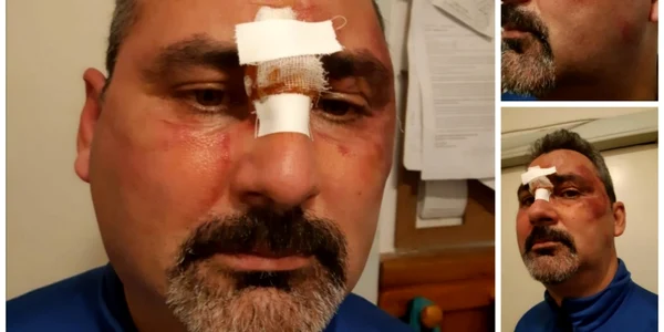 jurnalist batut slatina - foti arhiva alin balan