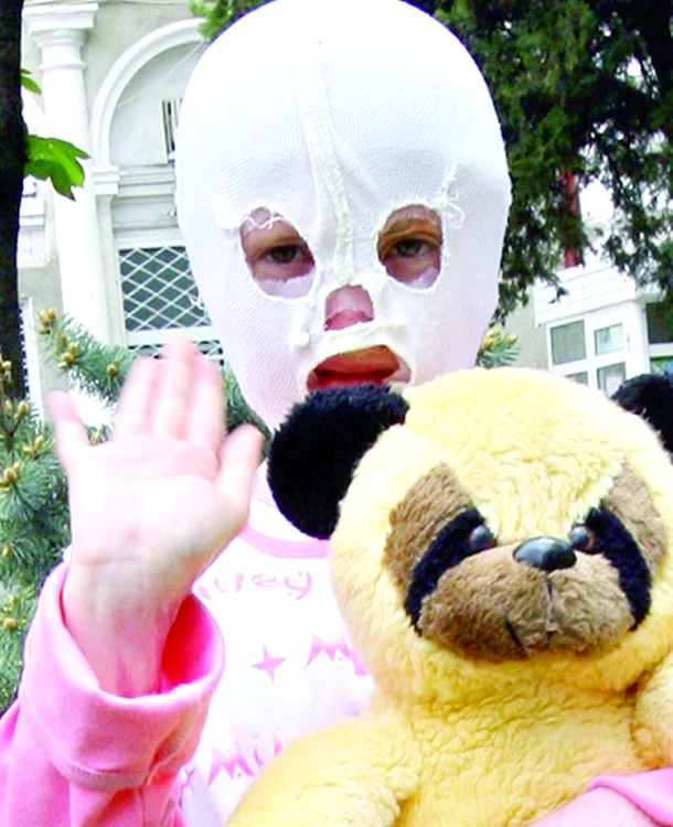 
    Viaţa Cristinei s-a schimbat pe 16 aprilie 2010, în urma unui teribil accident care i-a produs arsuri pe o suprafaţă de 70% din corp  