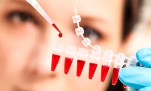 test de sange cancer tratament cancer Shutterstock 
