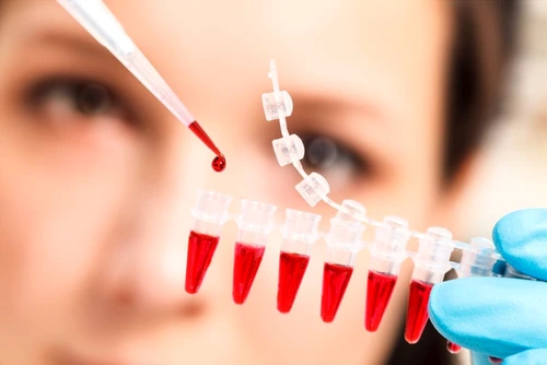 test de sange cancer tratament cancer Shutterstock 