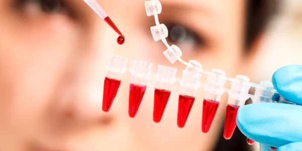 test de sange cancer tratament cancer Shutterstock 