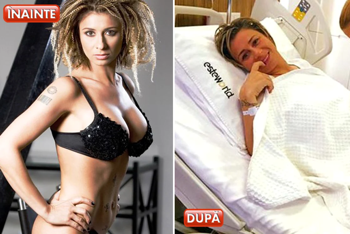 Vedete care au renunțat la silicoane. Anamaria Prodan și-a scos protezele vechi de 15 ani