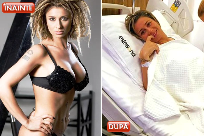 Vedete care au renunțat la silicoane. Anamaria Prodan și-a scos protezele vechi de 15 ani