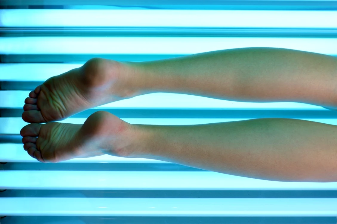 Bronzatul la solar crește riscul de cancer de piele FOTO Shutterstock