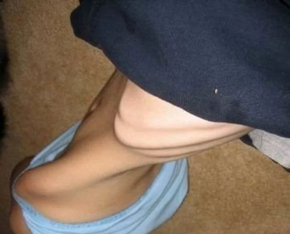 Anorexicele sunt sexy?
