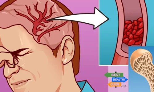 1 12 semne care iti spun ca ai deficienta de magneziu in corp dvce jpg jpeg