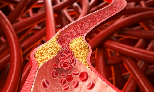 shutterstock 2603544127 jpg