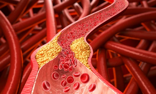 shutterstock 2603544127 jpg