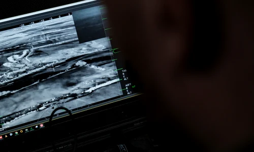 drone pe frontul din pokrovsj foto profimedia jpg