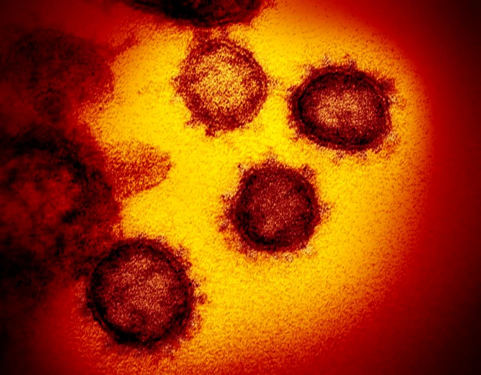 Un tratament folosind plasmă colectată din sângele persoanelor care s-au recuperat din noul coronavirus crește speranțele unei vindecări după ce medicii chinezi au descoperit că a ajutat pacienții bolnavi de critică