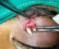 Dinte crescut ideasupra ochiului  Foto AAOJOURNAL (3) webp