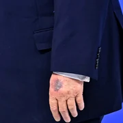 Donald Trump la Davos vânătaie pe mână FOTO AFP 20260122 jpg