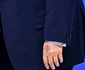 Donald Trump la Davos vânătaie pe mână FOTO AFP 20260122 jpg