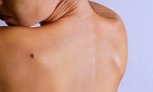 1 73189 original jpg jpeg