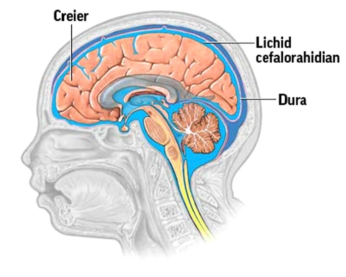 Neurologul Constantin Popa a explicat că, în condiții normale, orice om are 150 ml de lichid cefalo rahidian (LCR), acesta fiind un lichid clar, transparent care circulă de la creier la măduva spinării și care se elimină în sânge. 
