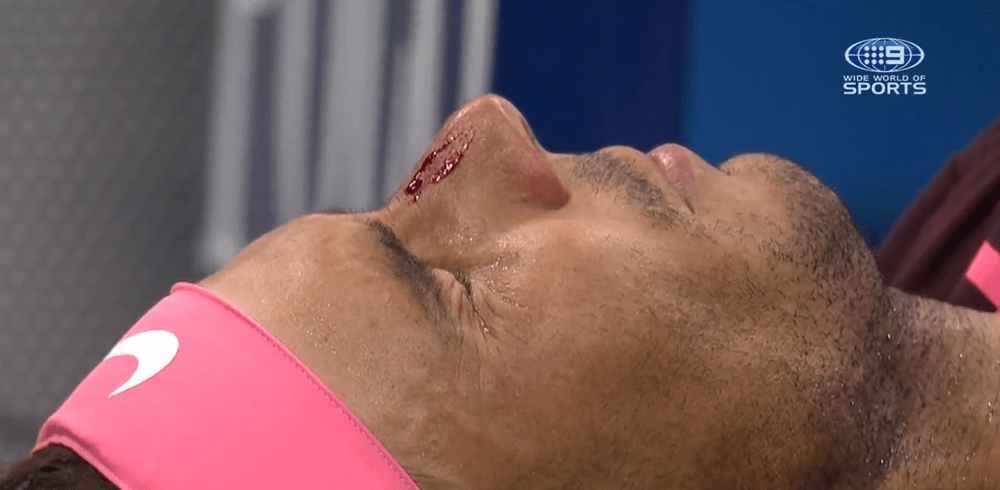 Panică la US Open: Nadal, accidentare bizară. Și-a spart nasul cu racheta VIDEO