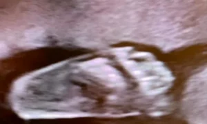 Ecografia bebelușului png