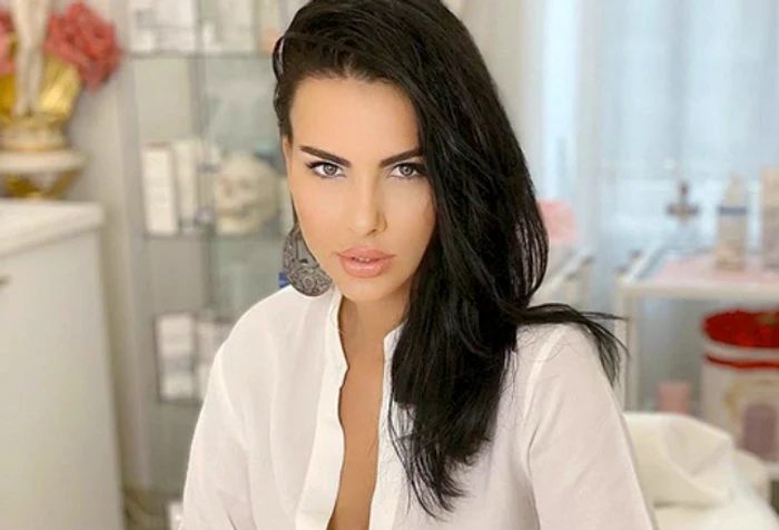 Lavinia Pârva a intrat într-un proces de remodelare și rejuvenare facialăfoto: arhivă personală