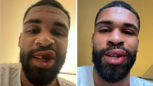 Un fotbalist de la AC Milan și-a pierdut dinții în meciul cu Parma. Fosta echipă a lui Chivu a decis în mare parte campioana