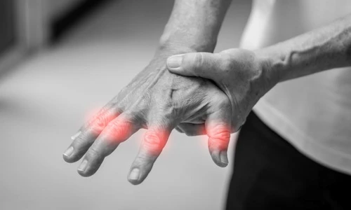 1 furnicaturi jpg jpeg