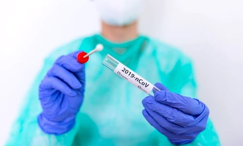 1 test covid jpg jpeg