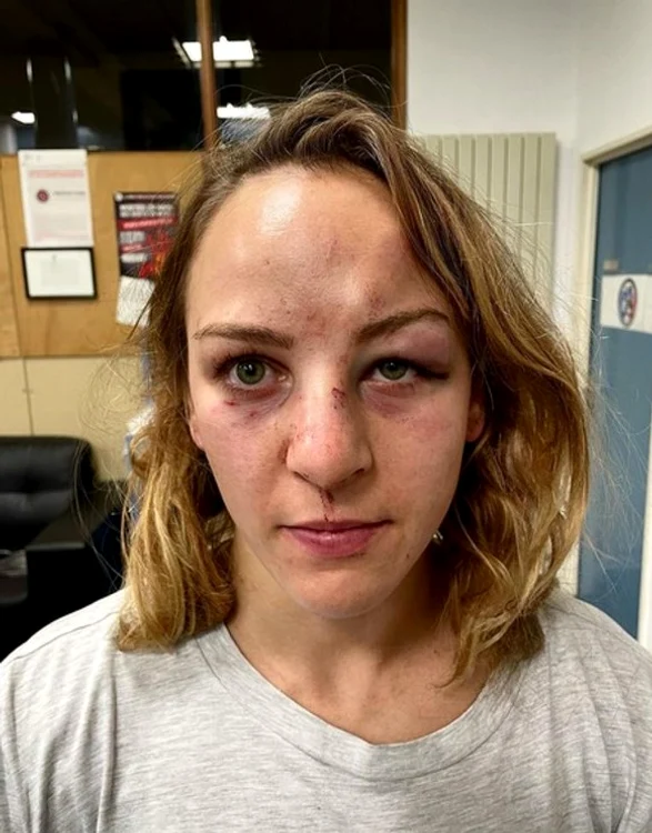 
    Margaux Pinot a postat o fotografie după bătaia primită de la antrenorFOTO: Instagram  
