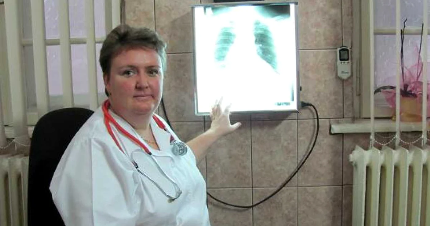 Dr. Mihaela Marţus cu radiografia unui fumător pasionat