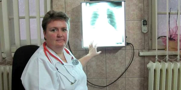 Dr. Mihaela Marţus cu radiografia unui fumător pasionat