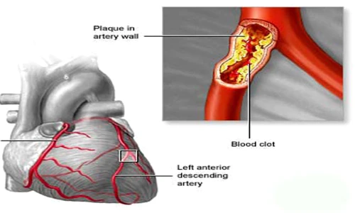 1 salveaza ti inima rinichii si creierul uite cum iti cureti arterele cu doar trei ingrediente c4yo jpg jpeg