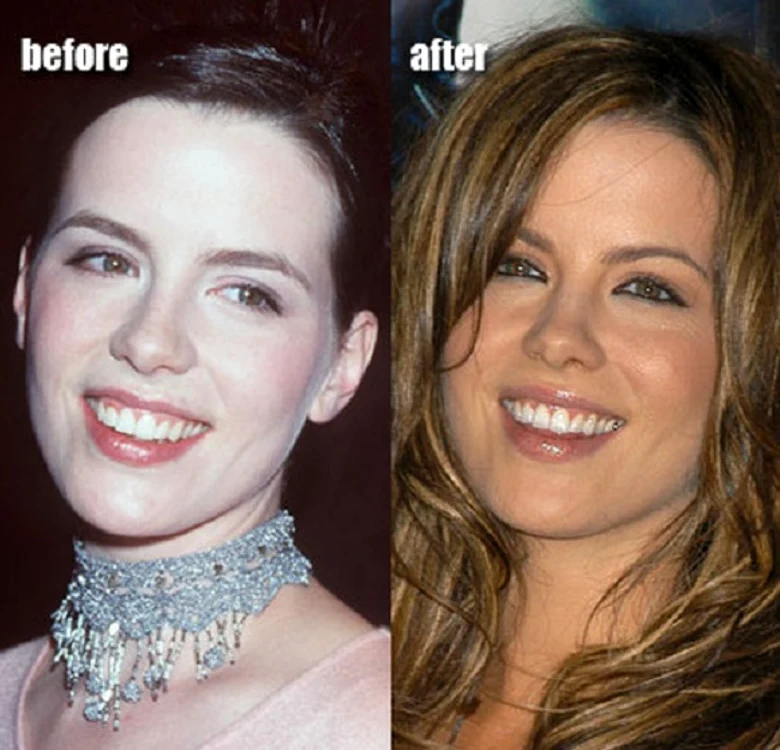 Kate Beckinsale